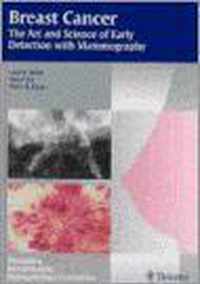 Mammography