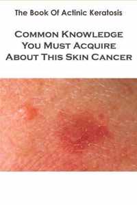 The Book Of Actinic Keratosis_ Common Knowledge You Must Acquire About This Skin Cancer