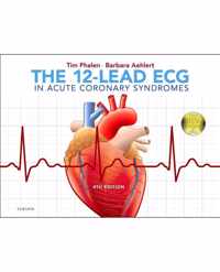 The 12-Lead ECG in Acute Coronary Syndromes