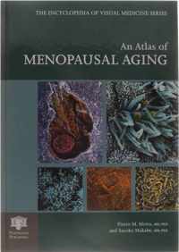 An Atlas of Menopausal Aging