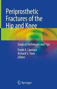 Periprosthetic Fractures of the Hip and Knee