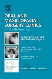 Reoperative Oral and Maxillofacial Surgery, An Issue of Oral and Maxillofacial Surgery Clinics