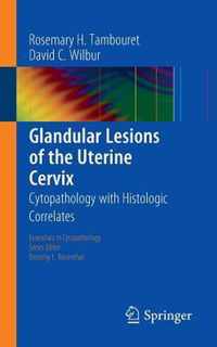 Glandular Lesions of the Uterine Cervix