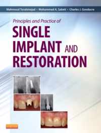 Principles And Practice Of Single Implant And Restoration