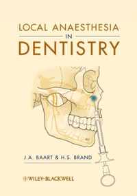 Local Anaesthesia in Dentistry