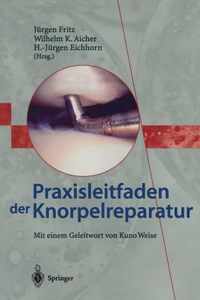 Praxisleitfaden Der Knorpelreparatur