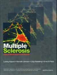 Multiple Sclerosis