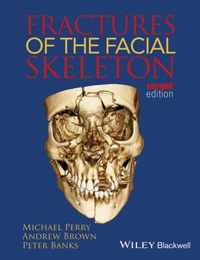 Fractures Of Facial Skeleton 2Nd Edition