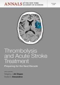 Thrombolysis and Acute Stoke