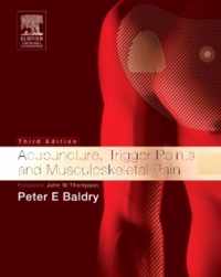 Acupuncture, Trigger Points and Musculoskeletal Pain