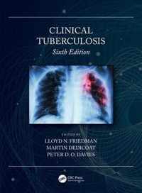 Clinical Tuberculosis