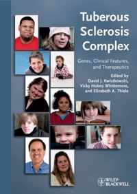 Tuberous Sclerosis Complex: Genes, Clinical Features and Therapeutics