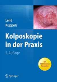 Kolposkopie In Der Praxis