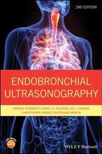 Endobronchial Ultrasonography