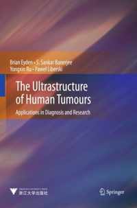 Ultrastructure Of Human Tumours