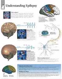 Understanding Epilepsy Laminated Poster