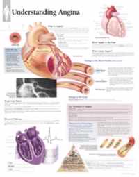 Understanding Angina Paper Poster