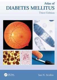 Atlas of Diabetes Mellitus