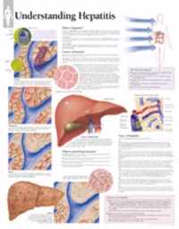 Understanding Hepatitis Laminated Poster