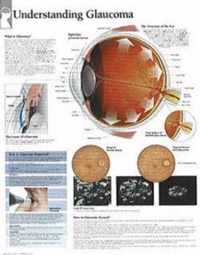 Understanding Glaucoma Paper Poster