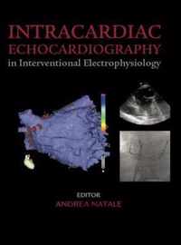 Intracardiac Echocardiography in Interventional Electrophysiology