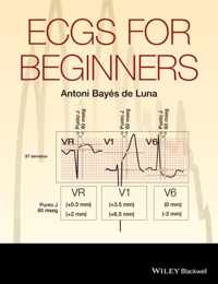 ECGs for Beginners