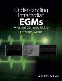 Understanding Intracardiac EGMs