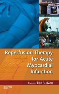 Reperfusion Therapy for Acute Myocardial Infarction