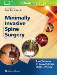 Minimally Invasive Spine Surgery