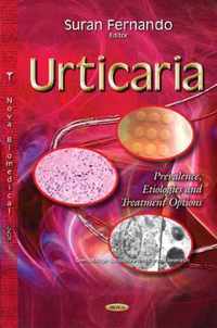 Urticaria