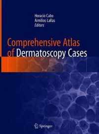 Comprehensive Atlas of Dermatoscopy Cases