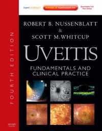 Uveitis