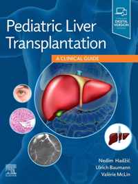 Pediatric Liver Transplantation