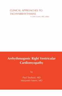 Touboul Arrhythmogenic Right Ventricular Cardiomyopathy