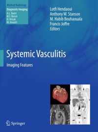 Systemic Vasculitis: Imaging Features