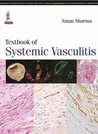 Textbook of Systemic Vasculitis