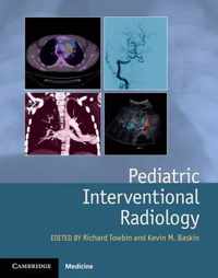 Pediatric Interventional Radiology