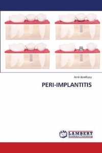 Peri-Implantitis