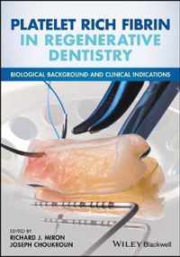 Platelet Rich Fibrin in Regenerative Dentistry: Biological Background and Clinical Indications