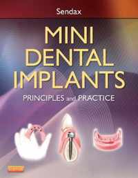 Mini Dental Implants