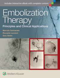 Embolization Therapy