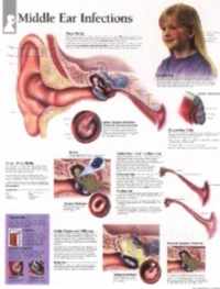 Middle Ear Infections Laminated Poster