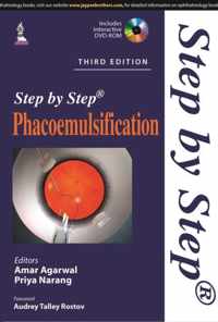 Step by Step Phacoemulsification