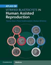 Atlas Of Vitrified Blastocysts In Human Assisted Reproductio