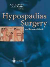 Hypospadias Surgery