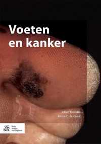 Voeten en kanker