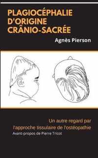 plagiocephalie d'origine cranio-sacree