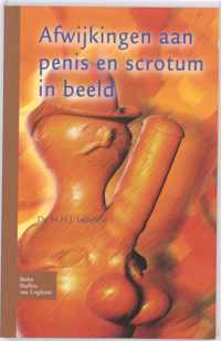 Afwijkingen aan penis en scrotum in beeld