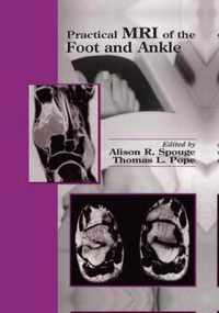 Practical MRI of the Foot and Ankle