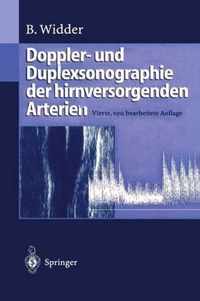 Doppler- und Duplexsonographie der Hirnversorgenden Arterien